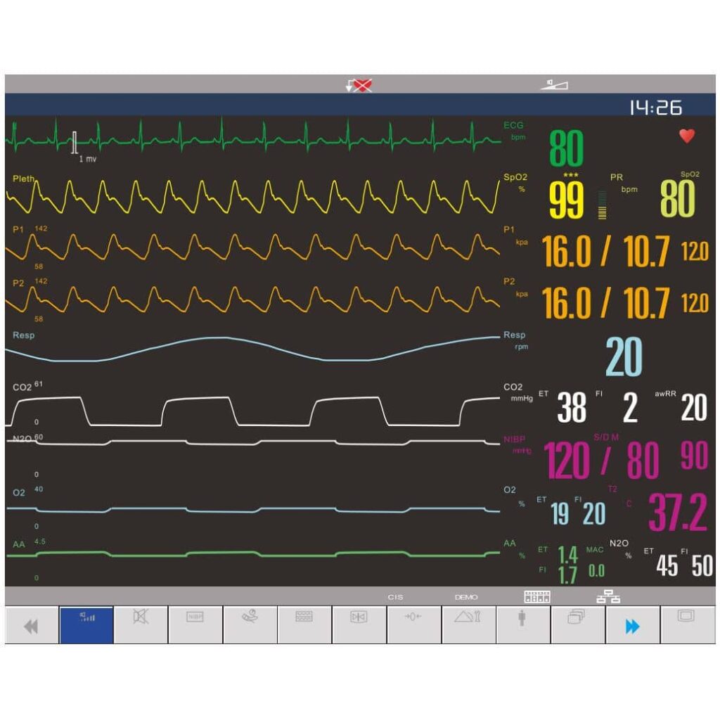 Macs Modular Patient Monitor By Sternmed Crescent Pulse